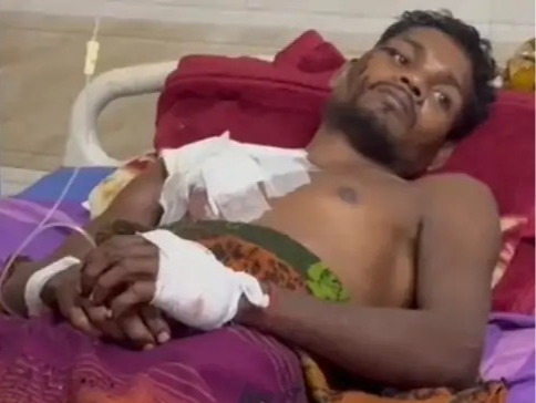 जंगली सुअर का खौफनाक हमला, घायल युवक को नहीं मिली एंबुलेंस… परिजन बाइक से अस्पताल पहुंचे। वन विभाग भी नदारद