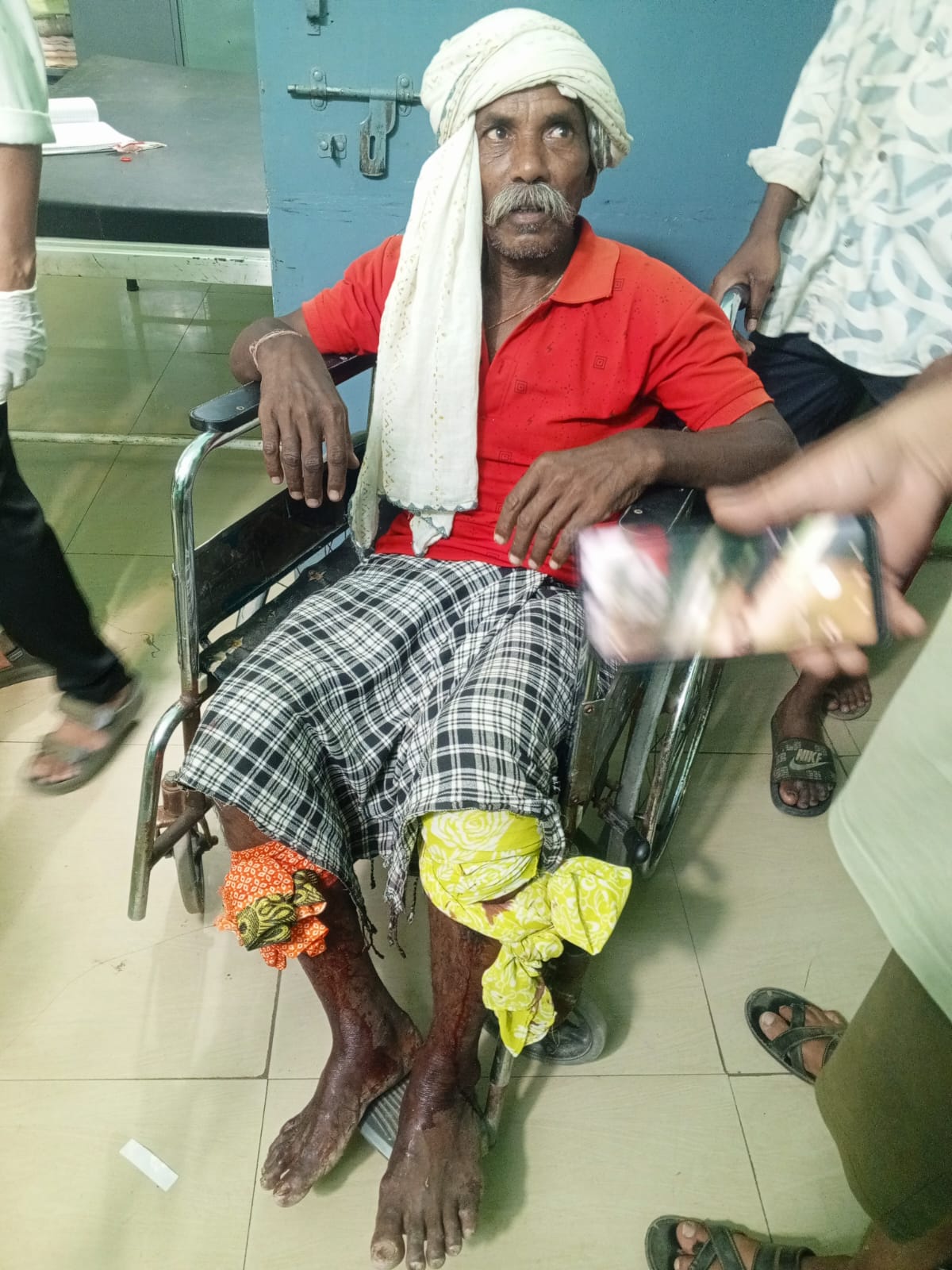 तेन्दु पत्ता तोड़ने गए दो ग्रामीणों पर भालू ने किया हमला,पाली क्षेत्र के ग्राम भादा का मामला